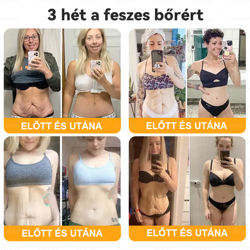 Magyarországról készült és szállított👩🏻‍⚕️✅PUROSA® Méhméreg Bőrfelújító Krém 🔥 UTOLSÓ NAP – 80% KEDVEZMÉNY🔥