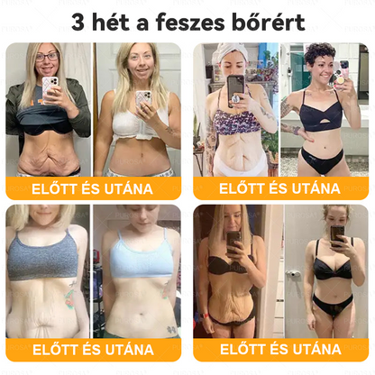 Magyarországról készült és szállított👩🏻‍⚕️✅PUROSA® Méhméreg Bőrfelújító Krém 🔥 UTOLSÓ NAP – 80% KEDVEZMÉNY🔥