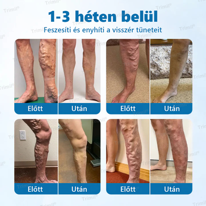 💎Trimil® VeinGuard Gyógynövényes Spray💎 - Klinikailag bizonyított, hogy mindössze 7 nap alatt megszünteti a visszereket!✨