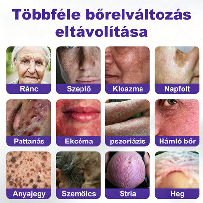 🌟CleraNaure® mikrotűs szemölcs- és anyajegyeltávolító tapasz