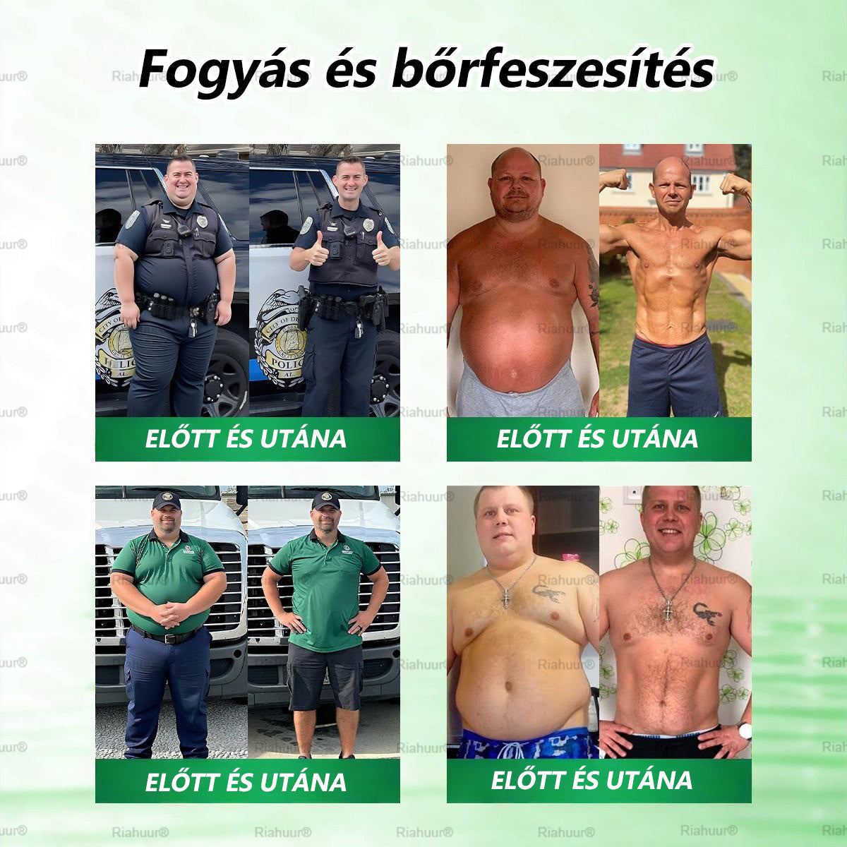 💐𝑹𝒊𝒂𝒉𝒖𝒖𝒓® Moringa × Berberin × AMPK 8-Benefit Karcsúsító & Metabolikus Nano Mikrotűs Tapasz 🇭🇺 (Naponta csak egyszer, látható változások már 7 nap alatt) ✅ Elhízás, megereszkedett bőr, cukorbetegség, alvási apnoe, ízületi problémák és még sok más esetén 💥