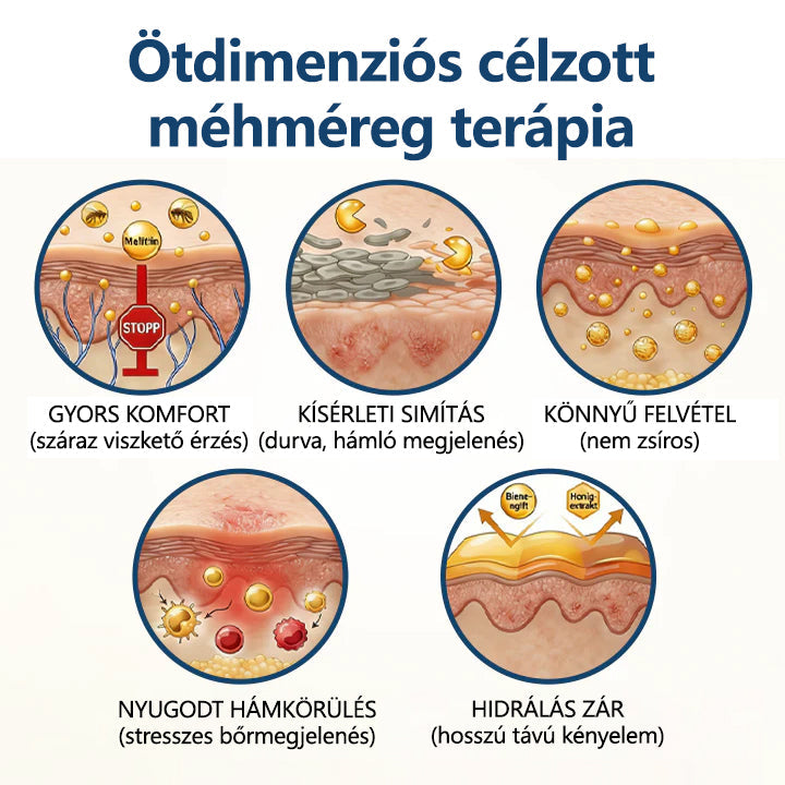 Timnik® méhméreg pikkelysömör elleni krém⭐️
