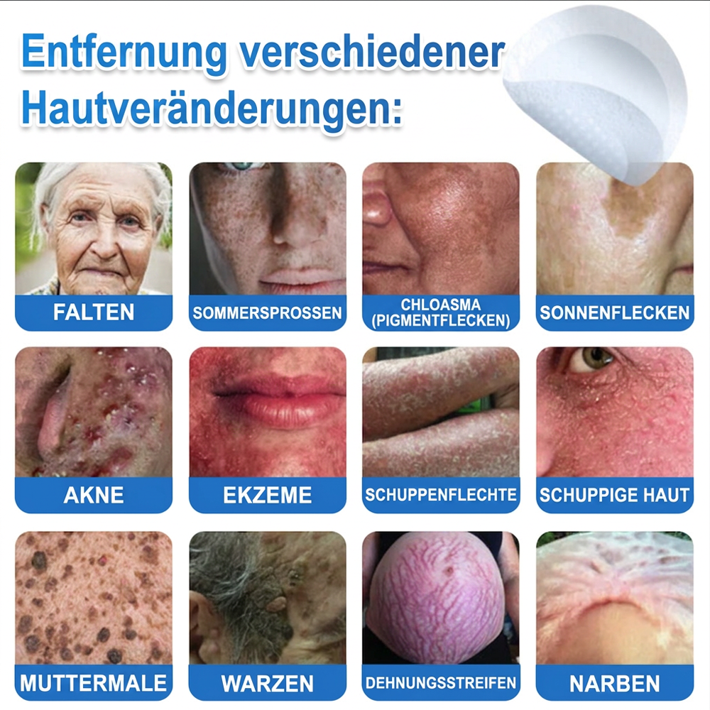 🏆Celsiora® 2-in-1 Mikronadel- & Hydrokolloid-Pflaster | Entferner für erhabene Muttermale, Akne, flache Warzen & Hautanhängsel | Verbessert Falten, Narben & Hautunreinheiten | Unsichtbare Stern-Pickelpflaster für Gesicht & Körper