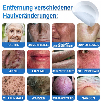 🏆Celsiora® 2-in-1 Mikronadel- & Hydrokolloid-Pflaster | Entferner für erhabene Muttermale, Akne, flache Warzen & Hautanhängsel | Verbessert Falten, Narben & Hautunreinheiten | Unsichtbare Stern-Pickelpflaster für Gesicht & Körper