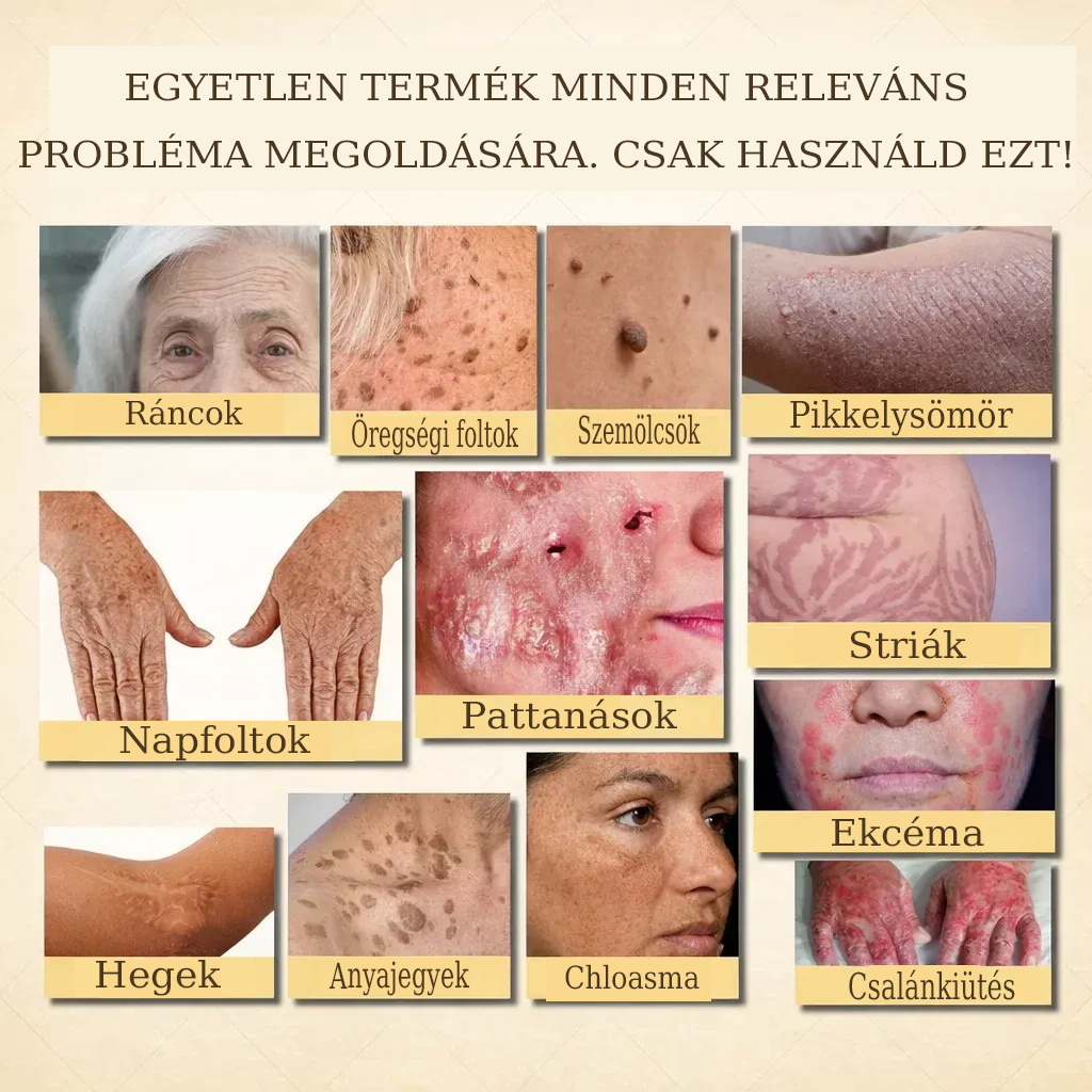 【𝐔𝐭𝐨𝐥𝐬𝐨́ 𝐍𝐚𝐩𝐨𝐬 𝐏𝐫𝐨𝐦ó𝐜𝐢ó 70% 𝐊𝐞𝐝𝐯𝐞́𝐳𝐦é𝐧𝐲】YITOWAY®  𝐌𝐚𝐫𝐡𝐚𝐟ő́𝐭𝐭 & 𝐌𝐞́𝐡𝐦é𝐫𝐠𝐞 𝐉𝐚𝐯í𝐭𝐨́ 𝐊𝐫é𝐦（aknék, ráncok és károsult bőrhez – szteroidmentes）