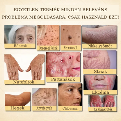 【𝐔𝐭𝐨𝐥𝐬𝐨́ 𝐍𝐚𝐩𝐨𝐬 𝐏𝐫𝐨𝐦ó𝐜𝐢ó 70% 𝐊𝐞𝐝𝐯𝐞́𝐳𝐦é𝐧𝐲】YITOWAY®  𝐌𝐚𝐫𝐡𝐚𝐟ő́𝐭𝐭 & 𝐌𝐞́𝐡𝐦é𝐫𝐠𝐞 𝐉𝐚𝐯í𝐭𝐨́ 𝐊𝐫é𝐦（aknék, ráncok és károsult bőrhez – szteroidmentes）