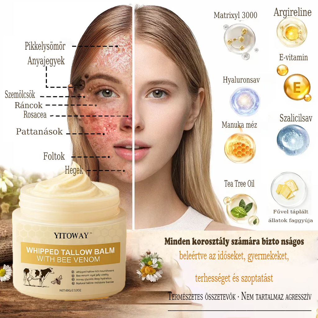 【𝐔𝐭𝐨𝐥𝐬𝐨́ 𝐍𝐚𝐩𝐨𝐬 𝐏𝐫𝐨𝐦ó𝐜𝐢ó 70% 𝐊𝐞𝐝𝐯𝐞́𝐳𝐦é𝐧𝐲】YITOWAY®  𝐌𝐚𝐫𝐡𝐚𝐟ő́𝐭𝐭 & 𝐌𝐞́𝐡𝐦é𝐫𝐠𝐞 𝐉𝐚𝐯í𝐭𝐨́ 𝐊𝐫é𝐦（aknék, ráncok és károsult bőrhez – szteroidmentes）