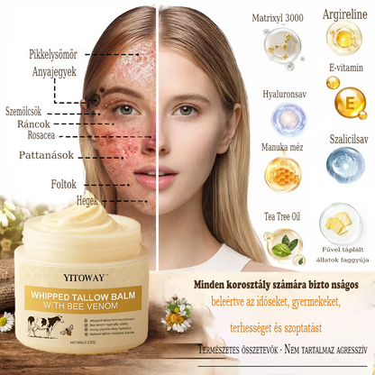 【𝐔𝐭𝐨𝐥𝐬𝐨́ 𝐍𝐚𝐩𝐨𝐬 𝐏𝐫𝐨𝐦ó𝐜𝐢ó 70% 𝐊𝐞𝐝𝐯𝐞́𝐳𝐦é𝐧𝐲】YITOWAY®  𝐌𝐚𝐫𝐡𝐚𝐟ő́𝐭𝐭 & 𝐌𝐞́𝐡𝐦é𝐫𝐠𝐞 𝐉𝐚𝐯í𝐭𝐨́ 𝐊𝐫é𝐦（aknék, ráncok és károsult bőrhez – szteroidmentes）