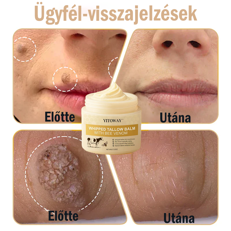 【𝐔𝐭𝐨𝐥𝐬𝐨́ 𝐍𝐚𝐩𝐨𝐬 𝐏𝐫𝐨𝐦ó𝐜𝐢ó 70% 𝐊𝐞𝐝𝐯𝐞́𝐳𝐦é𝐧𝐲】YITOWAY®  𝐌𝐚𝐫𝐡𝐚𝐟ő́𝐭𝐭 & 𝐌𝐞́𝐡𝐦é𝐫𝐠𝐞 𝐉𝐚𝐯í𝐭𝐨́ 𝐊𝐫é𝐦（aknék, ráncok és károsult bőrhez – szteroidmentes）