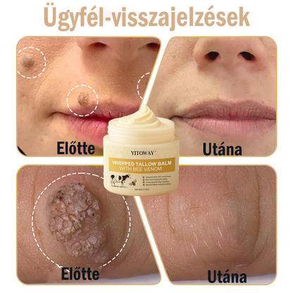 【𝐔𝐭𝐨𝐥𝐬𝐨́ 𝐍𝐚𝐩𝐨𝐬 𝐏𝐫𝐨𝐦ó𝐜𝐢ó 70% 𝐊𝐞𝐝𝐯𝐞́𝐳𝐦é𝐧𝐲】YITOWAY®  𝐌𝐚𝐫𝐡𝐚𝐟ő́𝐭𝐭 & 𝐌𝐞́𝐡𝐦é𝐫𝐠𝐞 𝐉𝐚𝐯í𝐭𝐨́ 𝐊𝐫é𝐦（aknék, ráncok és károsult bőrhez – szteroidmentes）