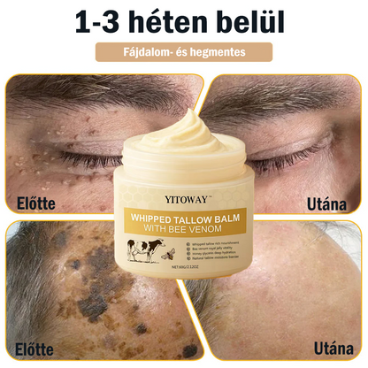 【𝐔𝐭𝐨𝐥𝐬𝐨́ 𝐍𝐚𝐩𝐨𝐬 𝐏𝐫𝐨𝐦ó𝐜𝐢ó 70% 𝐊𝐞𝐝𝐯𝐞́𝐳𝐦é𝐧𝐲】YITOWAY®  𝐌𝐚𝐫𝐡𝐚𝐟ő́𝐭𝐭 & 𝐌𝐞́𝐡𝐦é𝐫𝐠𝐞 𝐉𝐚𝐯í𝐭𝐨́ 𝐊𝐫é𝐦（aknék, ráncok és károsult bőrhez – szteroidmentes）