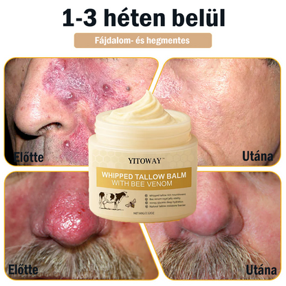 【𝐔𝐭𝐨𝐥𝐬𝐨́ 𝐍𝐚𝐩𝐨𝐬 𝐏𝐫𝐨𝐦ó𝐜𝐢ó 70% 𝐊𝐞𝐝𝐯𝐞́𝐳𝐦é𝐧𝐲】YITOWAY®  𝐌𝐚𝐫𝐡𝐚𝐟ő́𝐭𝐭 & 𝐌𝐞́𝐡𝐦é𝐫𝐠𝐞 𝐉𝐚𝐯í𝐭𝐨́ 𝐊𝐫é𝐦（aknék, ráncok és károsult bőrhez – szteroidmentes）