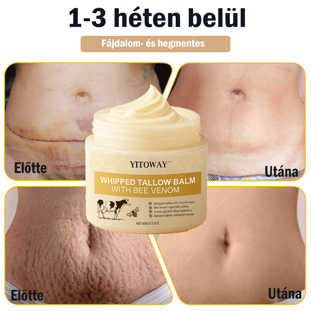 【𝐔𝐭𝐨𝐥𝐬𝐨́ 𝐍𝐚𝐩𝐨𝐬 𝐏𝐫𝐨𝐦ó𝐜𝐢ó 70% 𝐊𝐞𝐝𝐯𝐞́𝐳𝐦é𝐧𝐲】YITOWAY®  𝐌𝐚𝐫𝐡𝐚𝐟ő́𝐭𝐭 & 𝐌𝐞́𝐡𝐦é𝐫𝐠𝐞 𝐉𝐚𝐯í𝐭𝐨́ 𝐊𝐫é𝐦（aknék, ráncok és károsult bőrhez – szteroidmentes）