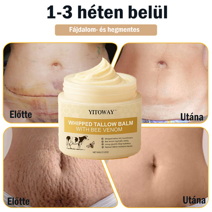 【𝐔𝐭𝐨𝐥𝐬𝐨́ 𝐍𝐚𝐩𝐨𝐬 𝐏𝐫𝐨𝐦ó𝐜𝐢ó 70% 𝐊𝐞𝐝𝐯𝐞́𝐳𝐦é𝐧𝐲】YITOWAY®  𝐌𝐚𝐫𝐡𝐚𝐟ő́𝐭𝐭 & 𝐌𝐞́𝐡𝐦é𝐫𝐠𝐞 𝐉𝐚𝐯í𝐭𝐨́ 𝐊𝐫é𝐦（aknék, ráncok és károsult bőrhez – szteroidmentes）