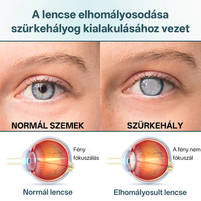 ✅Timilke® optiFusion Nanoszemcsepp szérum⭐⭐