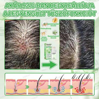 🍍𝐘𝐀𝐈𝐈𝐄𝐎® 𝑭á𝒋𝒅𝒂𝒍𝒐𝒎𝒎𝒆𝒏𝒕𝒆𝒔 𝑴𝒊𝒌𝒓𝒐𝒊𝒏𝒇ú𝒛𝒊ó𝒔 𝑹𝒆𝒏𝒅𝒔𝒛𝒆𝒓 Mélyen ható DHT-blokkolás, hajhagymák újraaktiválása és látható hajnövekedés