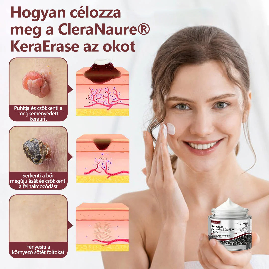 ⭐💎Hivatalos áruház👨‍⚕️ CleraNaure® KeraErase - Kettős hatású bőrfiatalító krém 👨‍⚕️ (Kettős hatású fiatalítás – simítja a kiemelkedő dudorokat és lebontja a mélyen lerakódott keratint savak és irritáció nélkül)