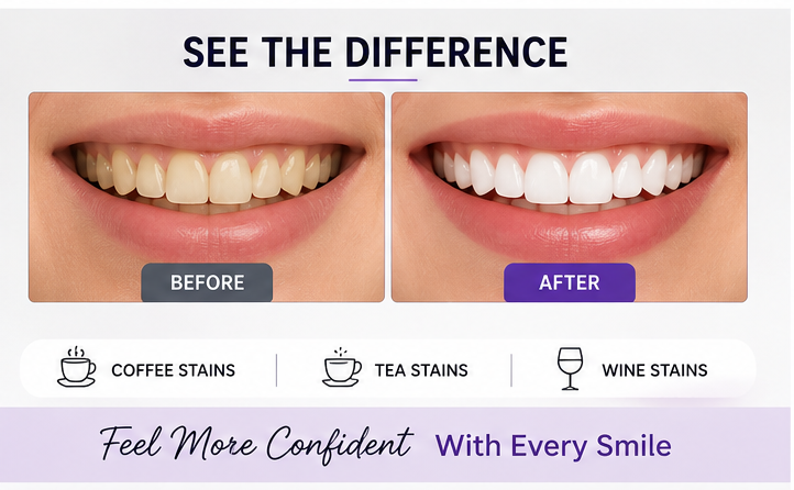 Instant Violet Color Correcting Strips