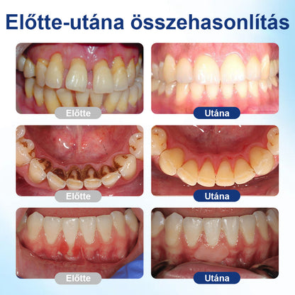 🔥🔥Laleia® BeeTakt szájápoló oldat