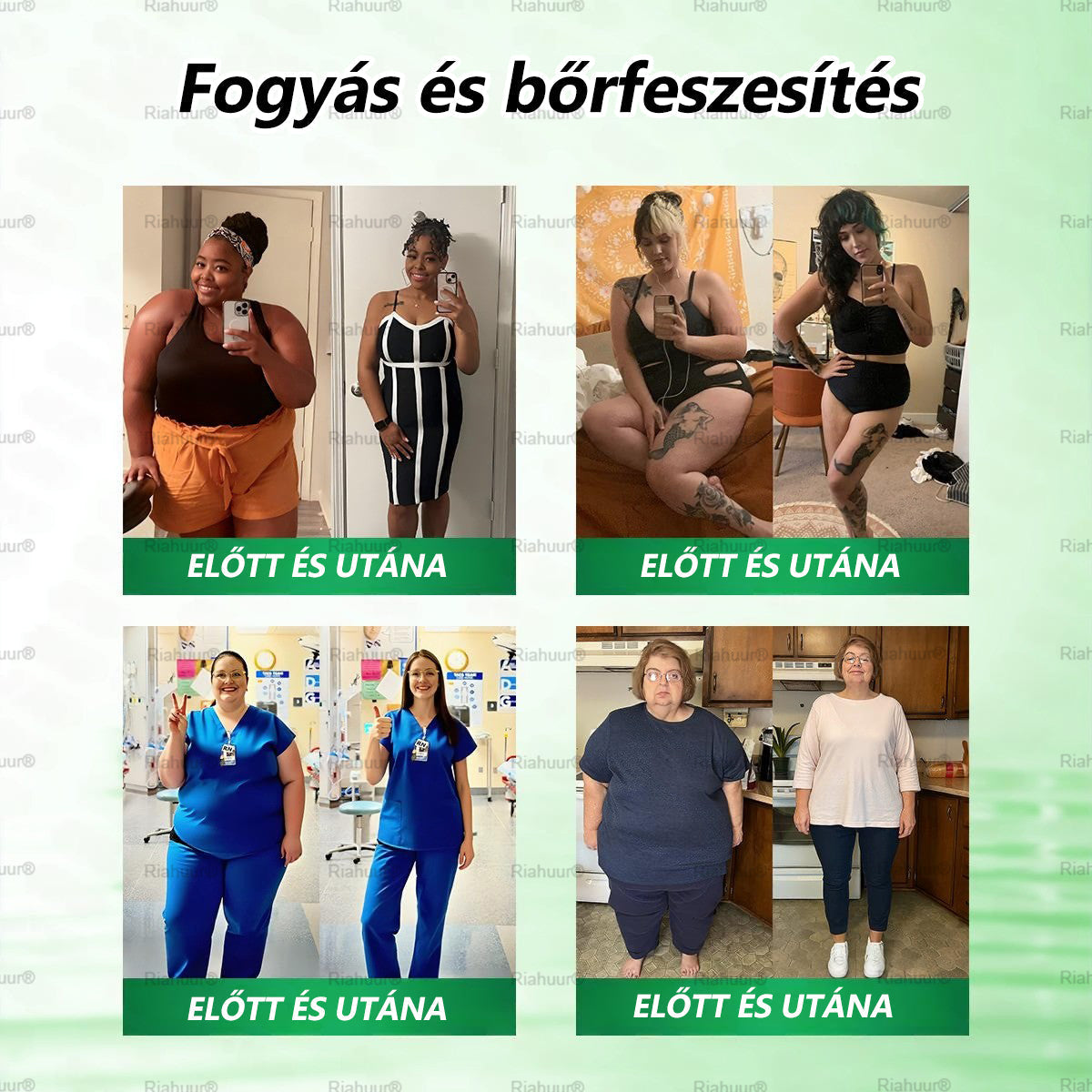 💐𝑹𝒊𝒂𝒉𝒖𝒖𝒓® Moringa × Berberin × AMPK 8-Benefit Karcsúsító & Metabolikus Nano Mikrotűs Tapasz 🇭🇺 (Naponta csak egyszer, látható változások már 7 nap alatt) ✅ Elhízás, megereszkedett bőr, cukorbetegség, alvási apnoe, ízületi problémák és még sok más esetén 💥
