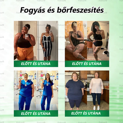 💐𝑹𝒊𝒂𝒉𝒖𝒖𝒓® Moringa × Berberin × AMPK 8-Benefit Karcsúsító & Metabolikus Nano Mikrotűs Tapasz 🇭🇺 (Naponta csak egyszer, látható változások már 7 nap alatt) ✅ Elhízás, megereszkedett bőr, cukorbetegség, alvási apnoe, ízületi problémák és még sok más esetén 💥