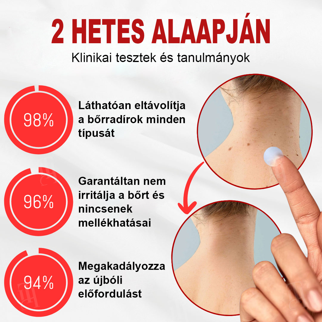 🫧CleraNature® WartAway Pro tapaszo