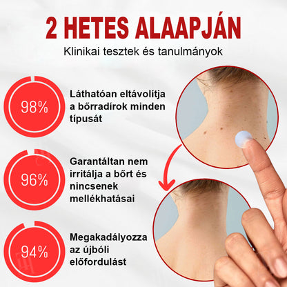 🫧CleraNature® WartAway Pro tapaszo