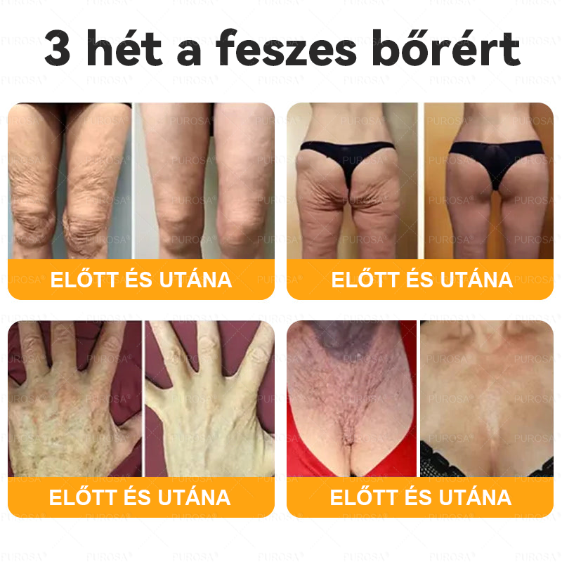 Magyarországról készült és szállított👩🏻‍⚕️✅PUROSA® Méhméreg Bőrfelújító Krém 🔥 UTOLSÓ NAP – 80% KEDVEZMÉNY🔥