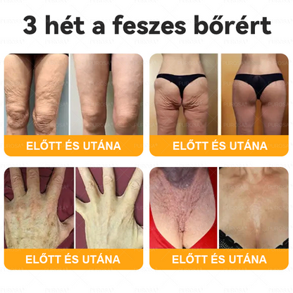 Magyarországról készült és szállított👩🏻‍⚕️✅PUROSA® Méhméreg Bőrfelújító Krém 🔥 UTOLSÓ NAP – 80% KEDVEZMÉNY🔥