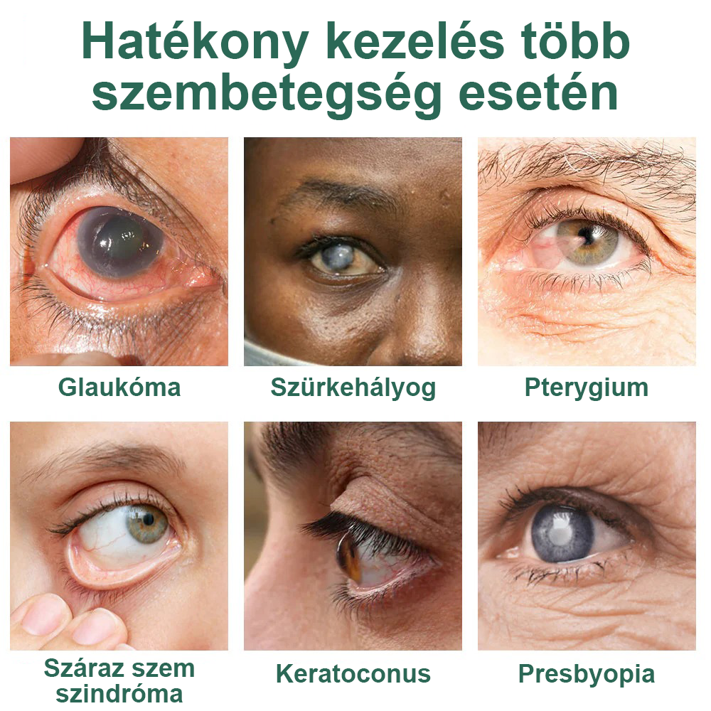 Ourlyarde® Nano Szemcsepp Szérum ✅ FDA által jóváhagyott(Alkalmas presbyopia, száraz szem szindróma, glaukóma és szürkehályog eseté⭐⭐