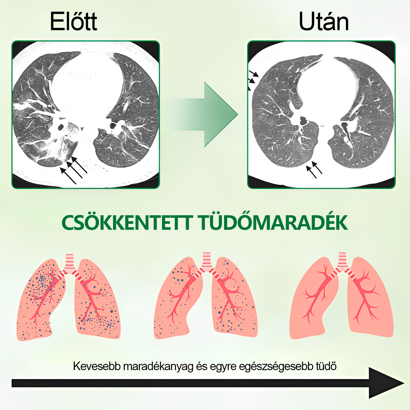 🍀🍀Gooyeer™ Fejlett Tüdőtisztító Spray - Tüdőspecialisták ajánlásával -CE tanúsítvánnyal rendelkezik