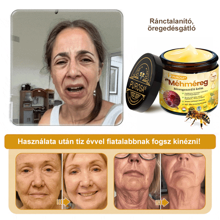 🐝PUROSA® Méhméreg Bőrregeneráló Krém | Teljes körű megoldás makacs bőrproblémákra, például öregedés, ekcéma, hegek és pikkelysömör ellen 🌿✨