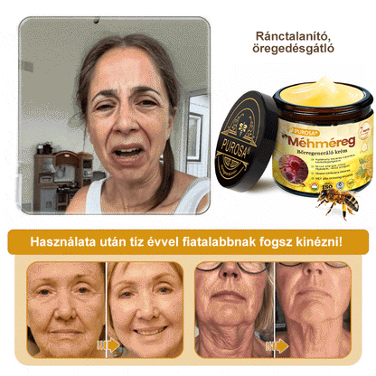 🐝PUROSA® Méhméreg Bőrregeneráló Krém | Teljes körű megoldás makacs bőrproblémákra, például öregedés, ekcéma, hegek és pikkelysömör ellen 🌿✨