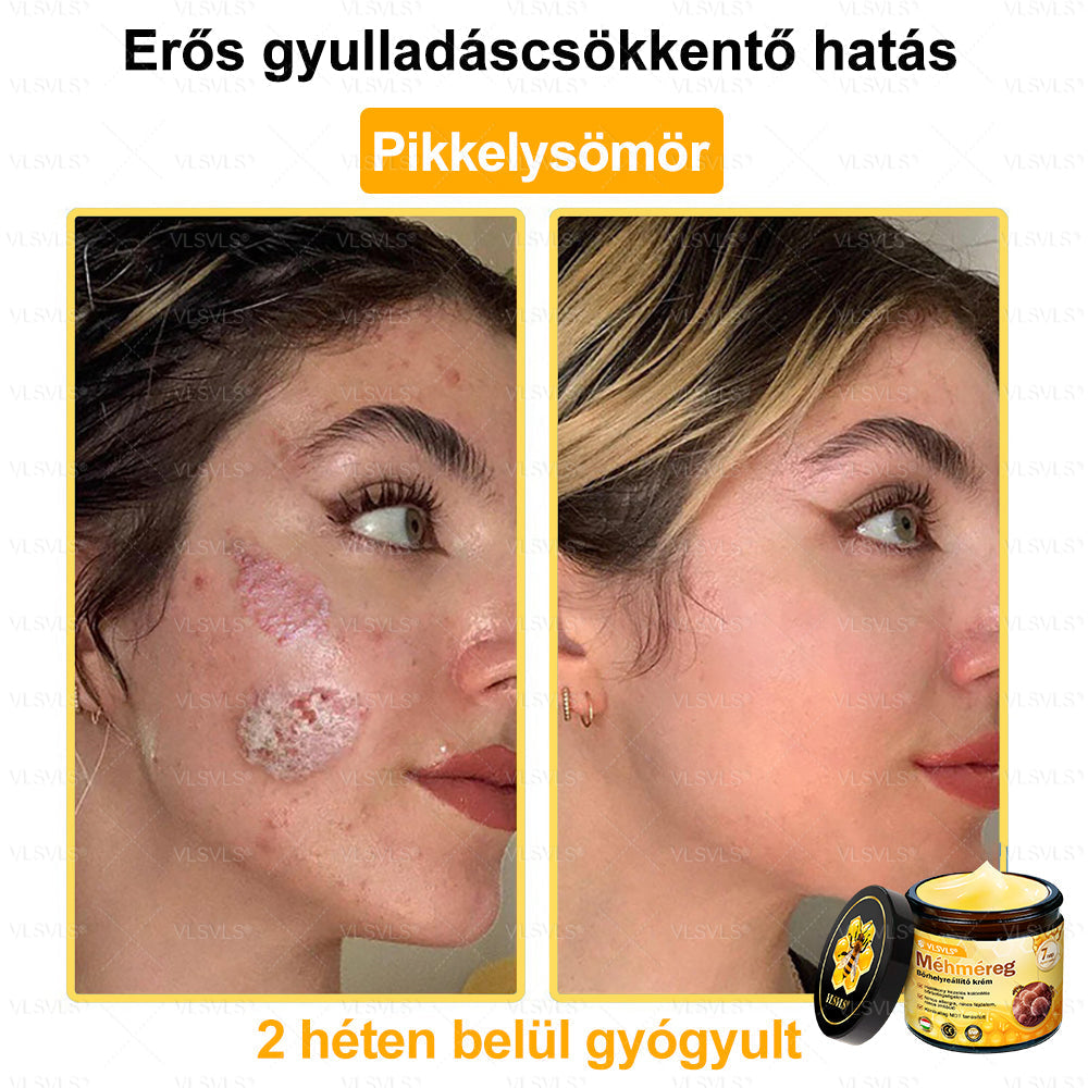 💜💜VLSVLS® Méhméreg Bőrhelyreállító Krém (👨‍⚕‍CE jóváhagyott)👍✅