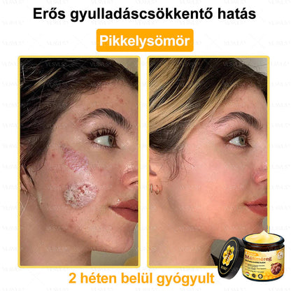 💜💜VLSVLS® Méhméreg Bőrhelyreállító Krém (👨‍⚕‍CE jóváhagyott)👍✅