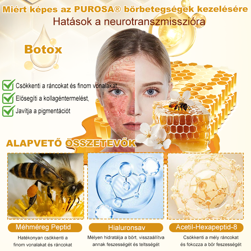 🐝PUROSA® Méhméreg Bőrregeneráló Krém | Teljes körű megoldás makacs bőrproblémákra, például öregedés, ekcéma, hegek és pikkelysömör ellen 🌿✨