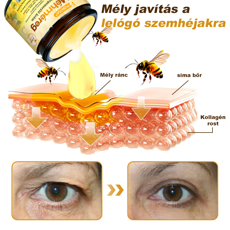 🐝PUROSA® Méhméreg Bőrregeneráló Krém | Teljes körű megoldás makacs bőrproblémákra, például öregedés, ekcéma, hegek és pikkelysömör ellen 🌿✨