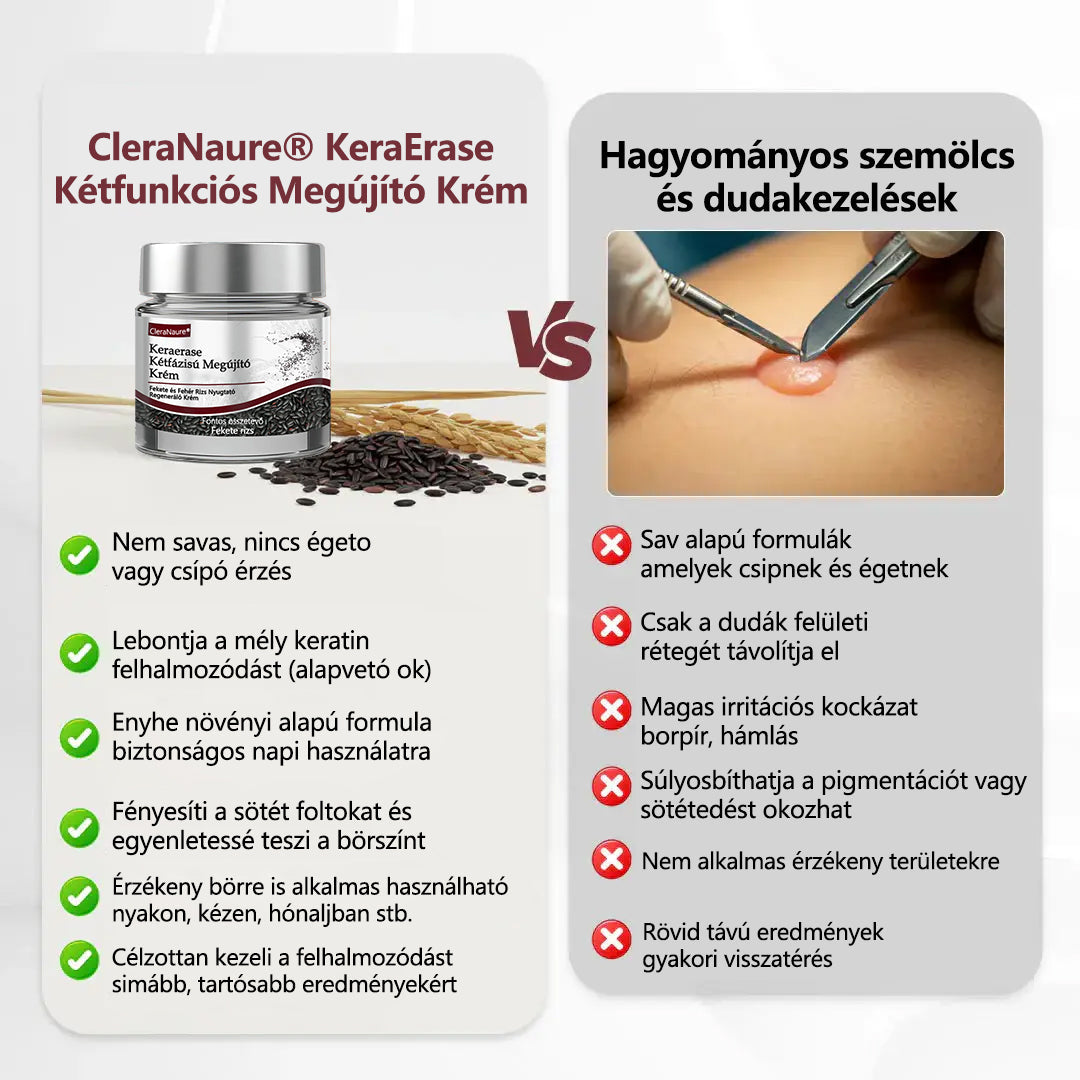 ⭐💎Hivatalos áruház👨‍⚕️ CleraNaure® KeraErase - Kettős hatású bőrfiatalító krém 👨‍⚕️ (Kettős hatású fiatalítás – simítja a kiemelkedő dudorokat és lebontja a mélyen lerakódott keratint savak és irritáció nélkül)