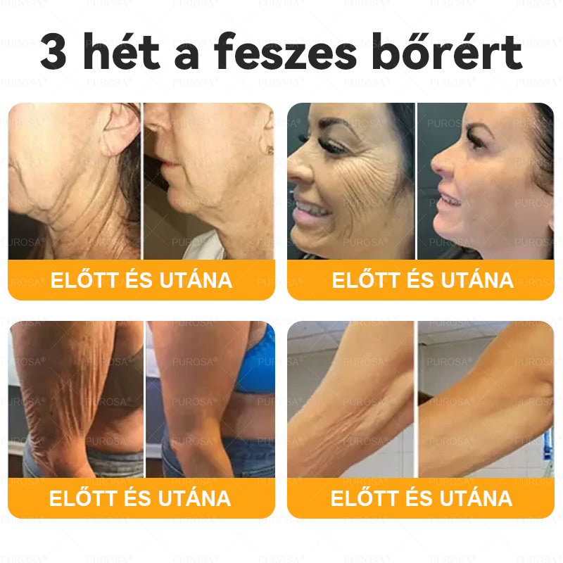 Magyarországról készült és szállított👩🏻‍⚕️✅PUROSA® Méhméreg Bőrfelújító Krém 🔥 UTOLSÓ NAP – 80% KEDVEZMÉNY🔥
