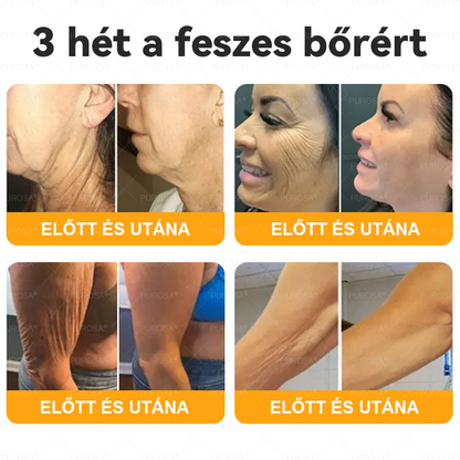 Magyarországról készült és szállított👩🏻‍⚕️✅PUROSA® Méhméreg Bőrfelújító Krém 🔥 UTOLSÓ NAP – 80% KEDVEZMÉNY🔥