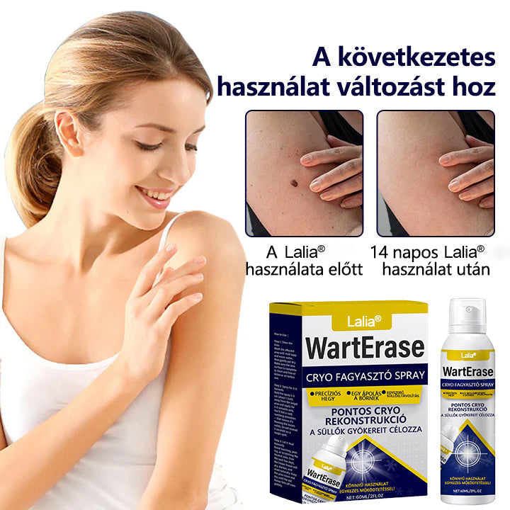 Laleia®✅✅✅ WartErase – Fagyasztó Szemölcseltávolító Spray