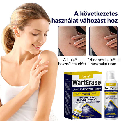 Laleia®✅✅✅ WartErase – Fagyasztó Szemölcseltávolító Spray