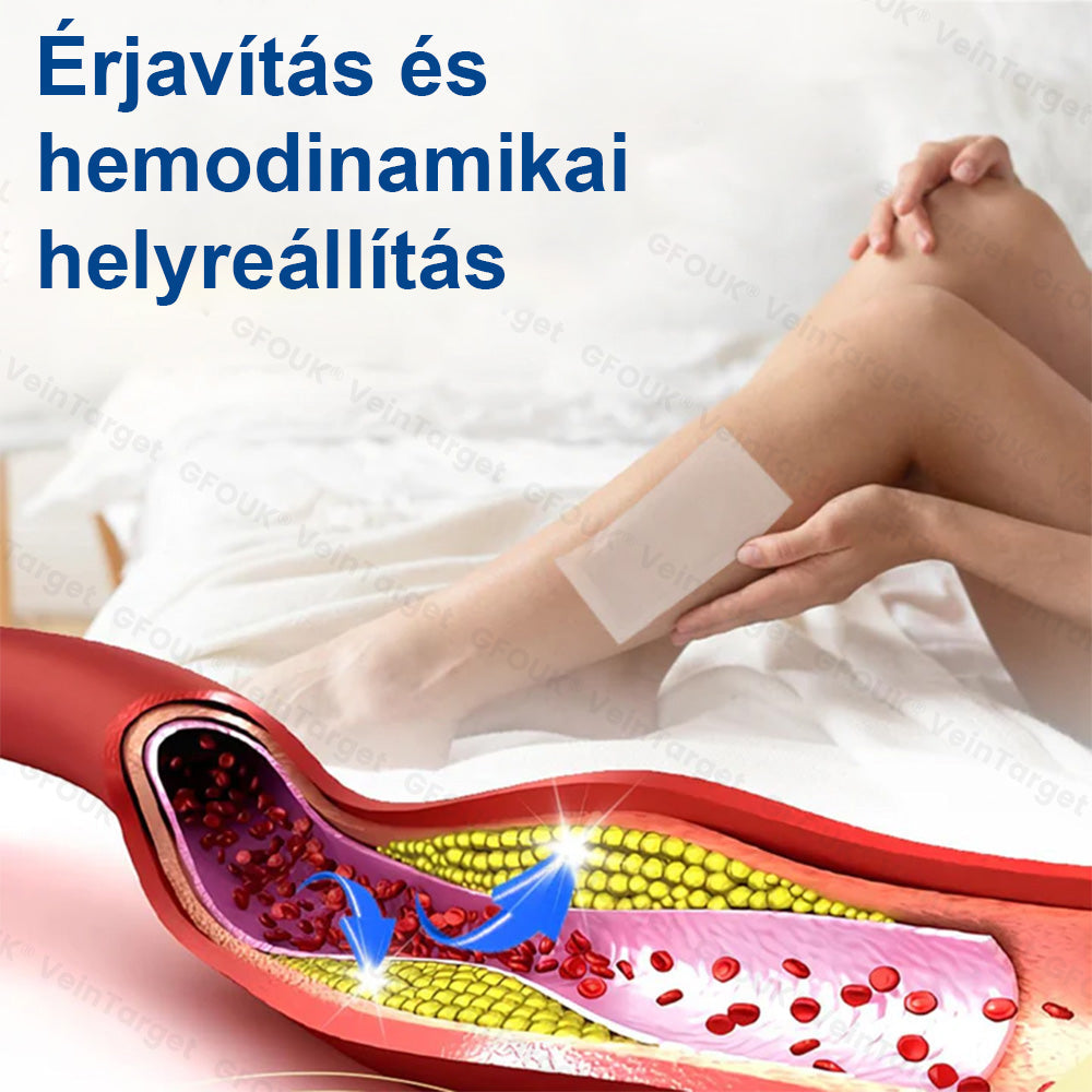 ✅✅✅Laleia® Vein Ease mikrotűs tapasz