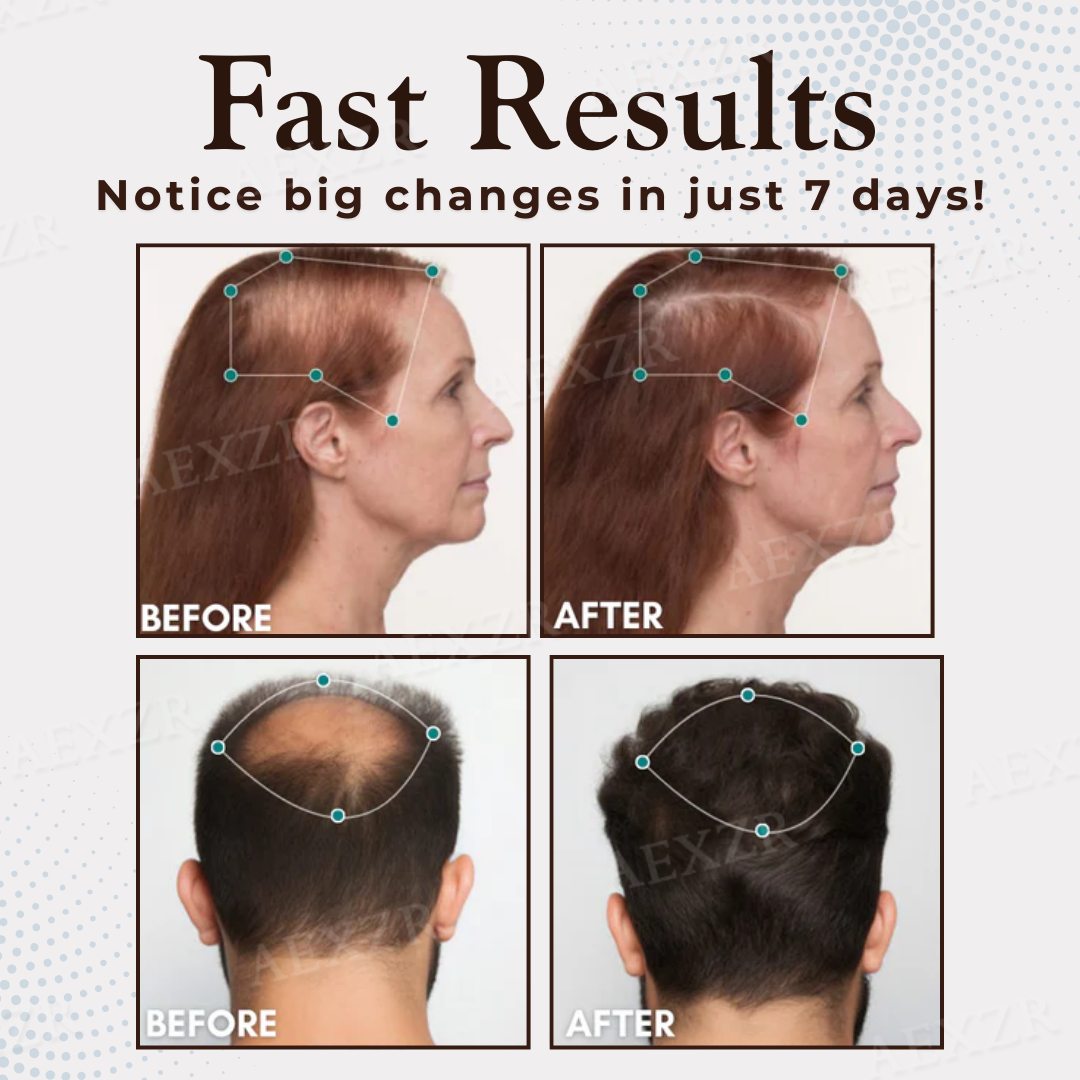 Best Seller 🎉limited-time discount | Acezozla® Hair Regrowth Capsules 💖Revive Follicles, Boost Hair Volume