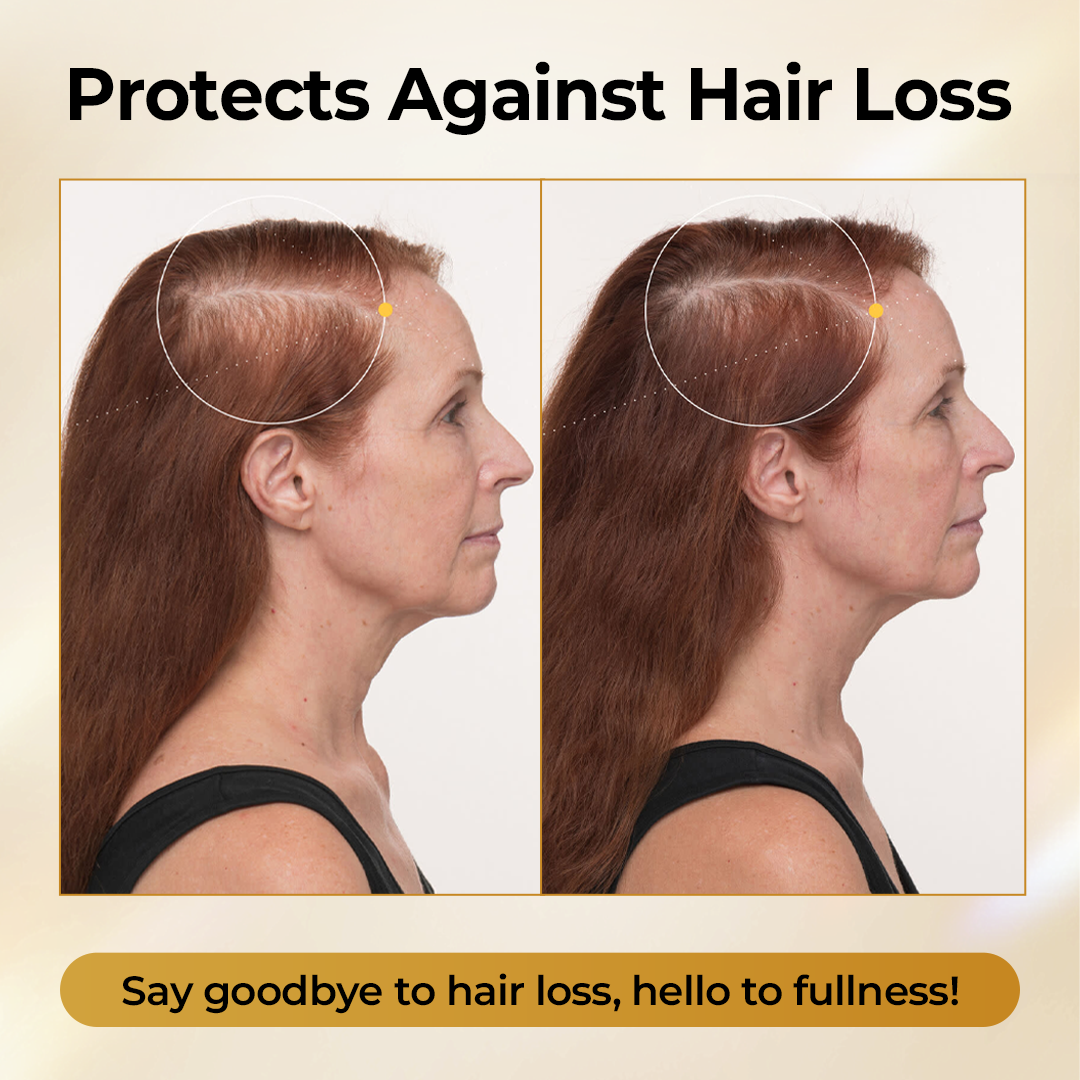 Acezozla® CollagenGrow Peptides Hair Growth Spray