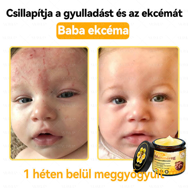 💜💜VLSVLS® Méhméreg Bőrhelyreállító Krém (👨‍⚕‍CE jóváhagyott)👍✅