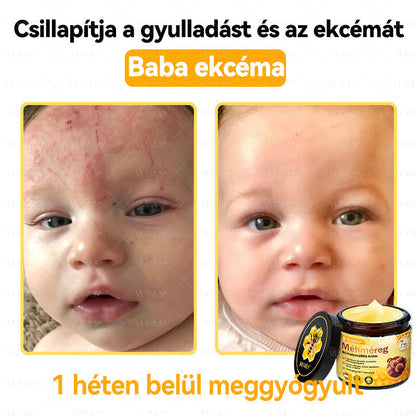 💜💜VLSVLS® Méhméreg Bőrhelyreállító Krém (👨‍⚕‍CE jóváhagyott)👍✅