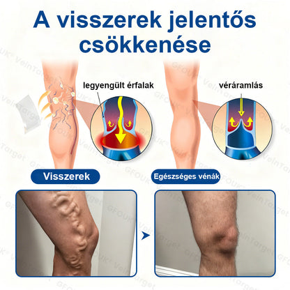 ✅✅✅Laleia® Vein Ease mikrotűs tapasz