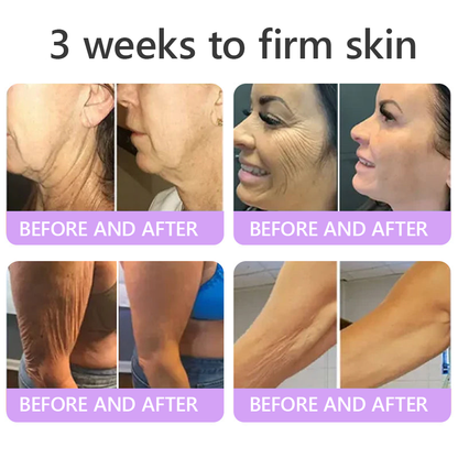 𝐇𝐈𝐒𝐊𝐈𝐍® 𝐏𝐃𝐑𝐍 𝐌𝐮𝐥𝐭𝐢-𝐏𝐞𝐩𝐭𝐢𝐝𝐞 𝐌𝐚𝐬𝐬𝐚𝐠𝐢𝐧𝐠 𝐁𝐨𝐝𝐲 𝐑𝐨𝐥𝐥𝐞𝐫 𝐂𝐫𝐞𝐚𝐦- Anti-aging, Hydrating, Skin Firming & Lifting, Skin Repair, Even Tone, Acne and Dark Spot Treatment, Wart and Mole Removal, and Psoriasis Relief.