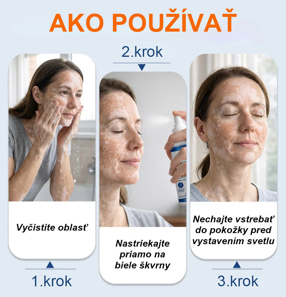 🌿🌿Laleia® Piperín Repigmentačný aktivačný sprej